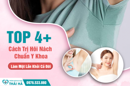 Top 4+ Cách Trị Hôi Nách Chuẩn Y Khoa, Làm Một Lần Khỏi Cả Đời