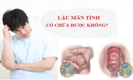 ĐỊA CHỈ KHÁM BỆNH LẬU CHÍNH XÁC Ở HÀ NỘI