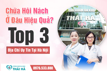 Chữa Hôi Nách Ở Đâu Hiệu Quả? Top 3 Địa Chỉ Uy Tín Tại Hà Nội
