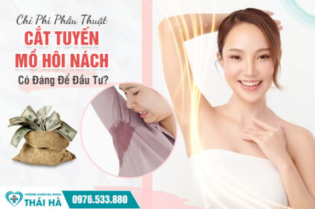Chi Phí Phẫu Thuật Cắt Tuyến Mồ Hôi Nách: Có Đáng Để Đầu Tư?