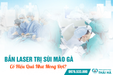 Bắn Laser Trị Sùi Mào Gà Có Hiệu Quả Như Mong Đợi?