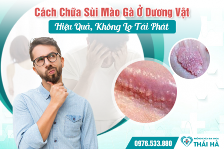 Cách Chữa Sùi Mào Gà Ở Dương Vật Hiệu Quả, Không Lo Tái Phát
