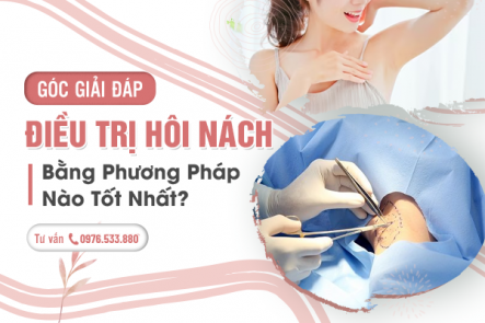 [GÓC GIẢI ĐÁP] Điều Trị Hôi Nách Bằng Phương Pháp Nào Tốt?