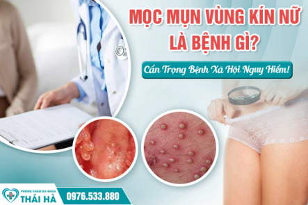 Mọc Mụn Vùng Kín Nữ Là Bệnh Gì? Cẩn Trọng Bệnh Xã Hội Nguy Hiểm!