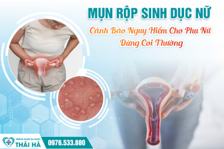 Mụn Rộp Sinh Dục Nữ: Cảnh Báo Nguy Hiểm Cho Phụ Nữ – Đừng Coi Thường!