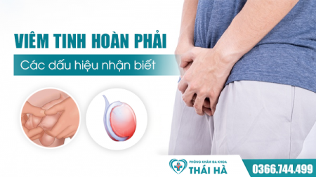 Viêm tinh hoàn phải - Nguyên nhân viêm tinh hoàn bên phải và cách chữa 